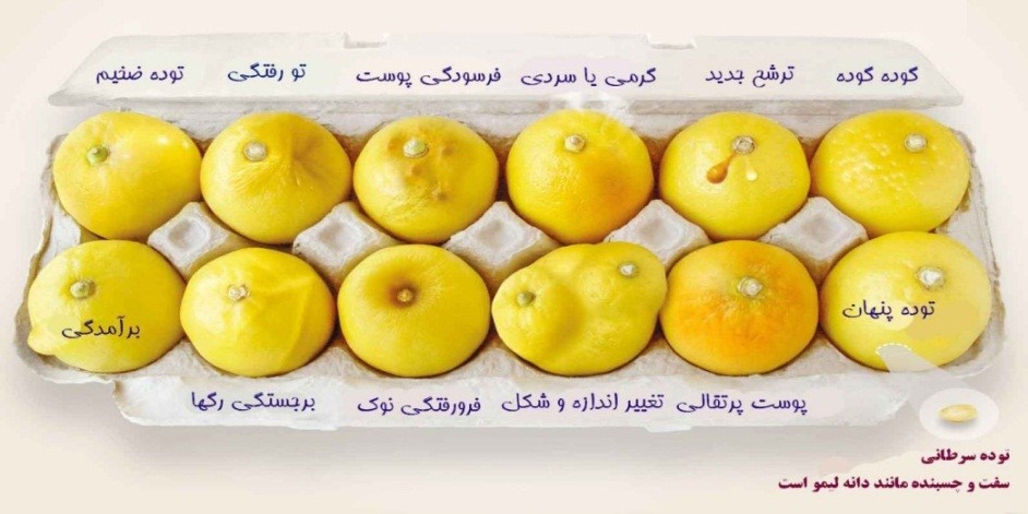 علائم سرطان پستان