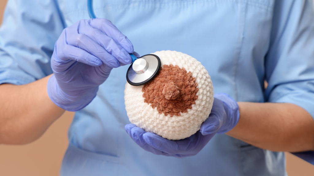 غربالگری سرطان پستان