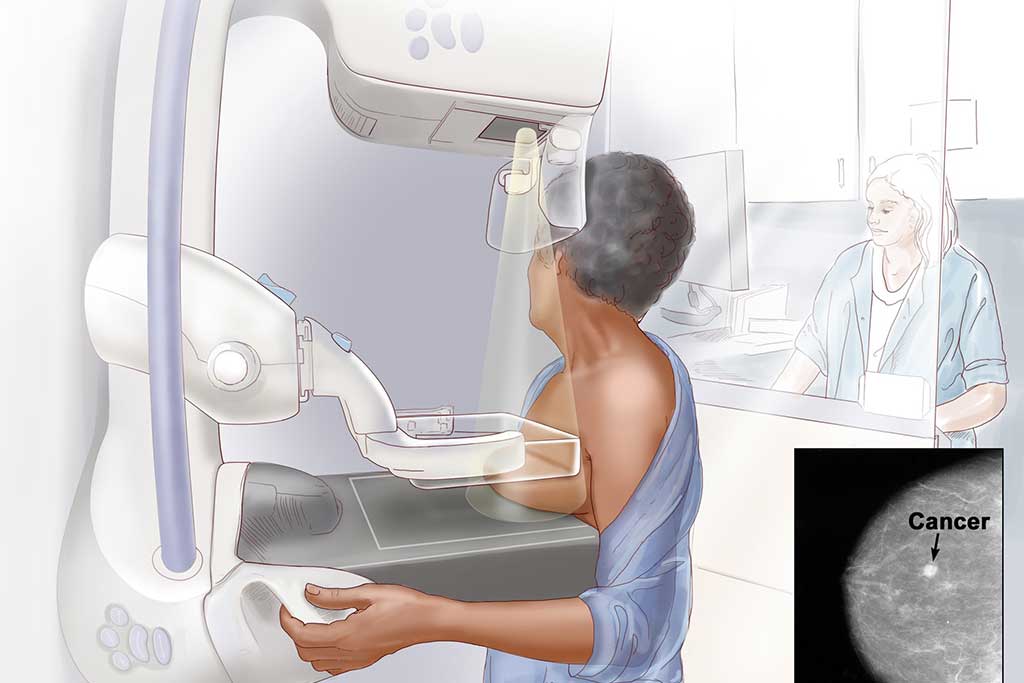 ماموگرافی پستان و زیربغل