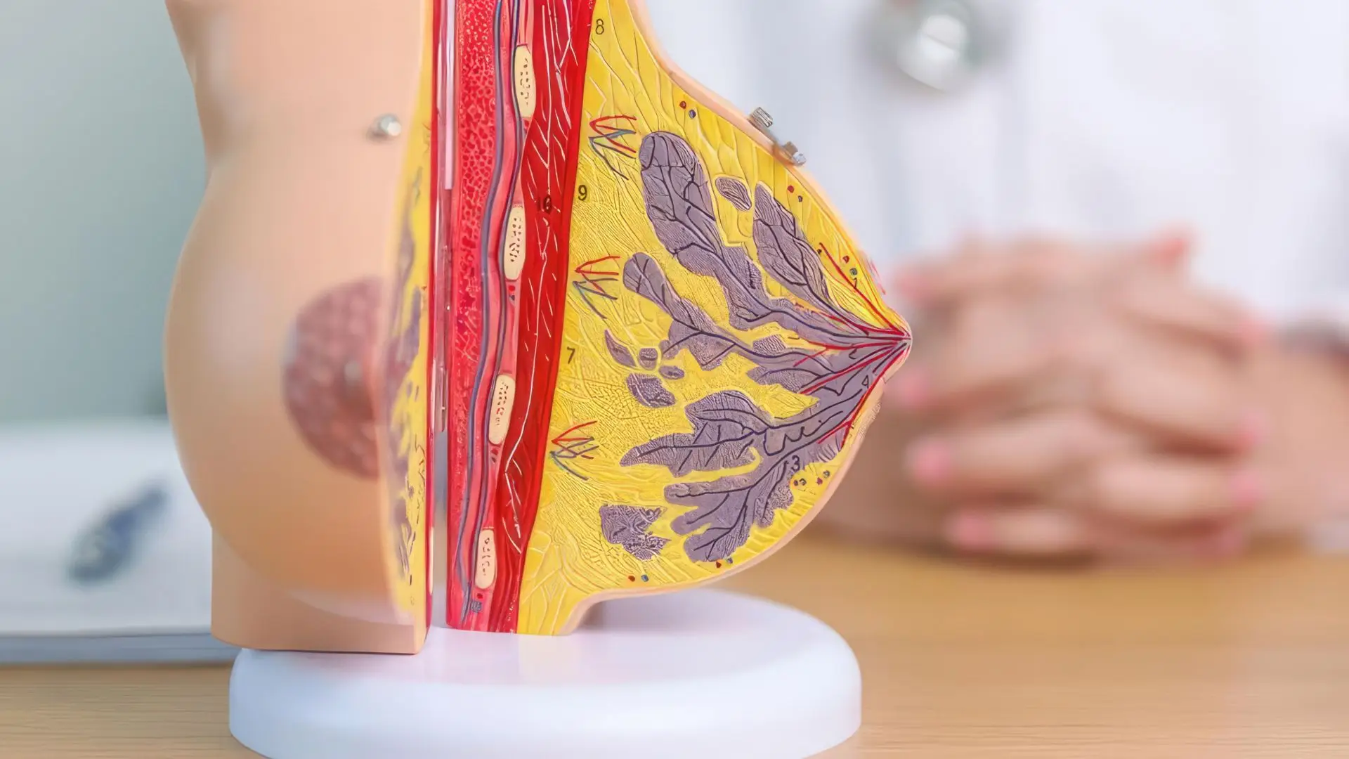 Triple Negative Breast Cancer