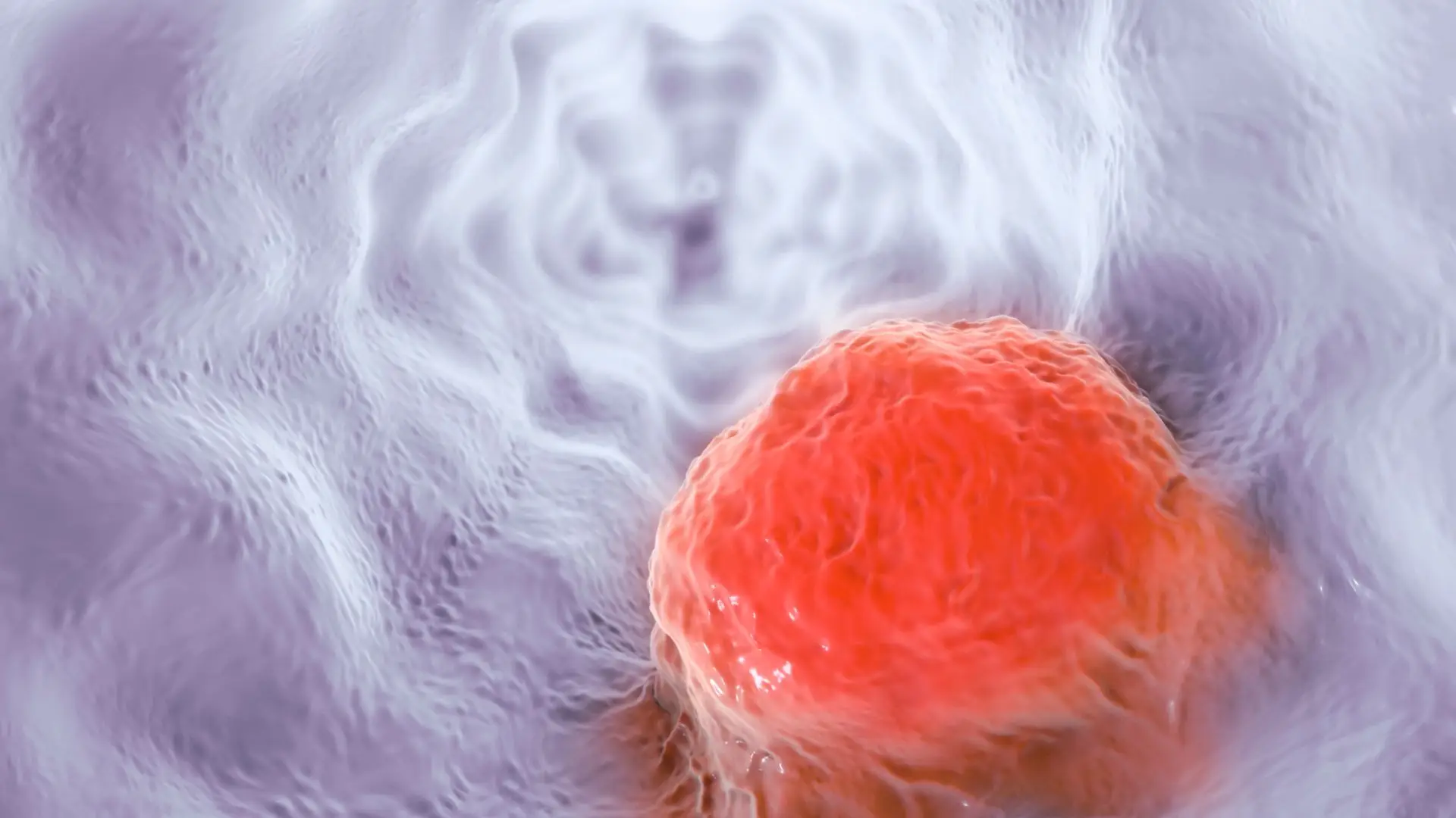 Triple Negative Breast Cancer 14 Triple Negative Breast Cancer 14